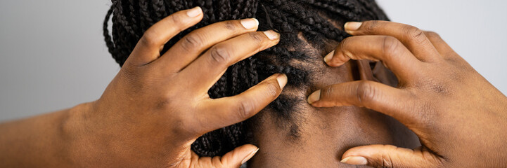 Itching Dry Head Scalp And Long Hair