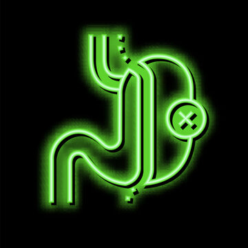 sleeve resection bariatric neon glow icon illustration