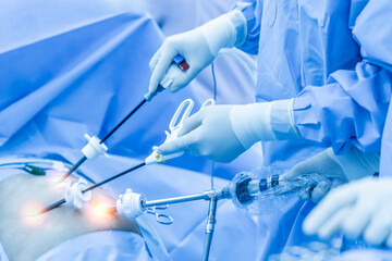 Team of doctor did laparoscopic cholecystectomy inside operating room in hospital.Surgeon hold medical instrument or surgical equipment in minimal invasive endoscopic surgery with light effect. - obrazy, fototapety, plakaty