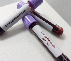 Blood sample for 5-HIAA (5-Hydroxyindoleacetic acid) test, used to help diagnose and monitor...