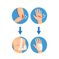 Process Of Injury Treatment And Bandaging, Infographics For Healthcare Or Medical-related Content. Hand With Wound