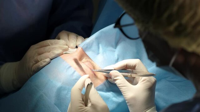 Blepharoplasty plastic surgery operation, focused on rejuvenation and modification of the eye region.