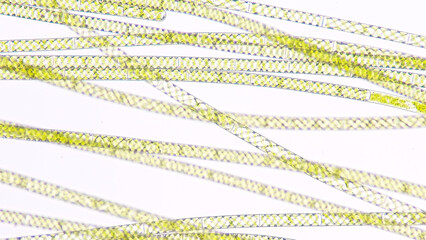 Spirogyra, a filamentous freshwater green algae with spiral arrangement of the chloroplasts