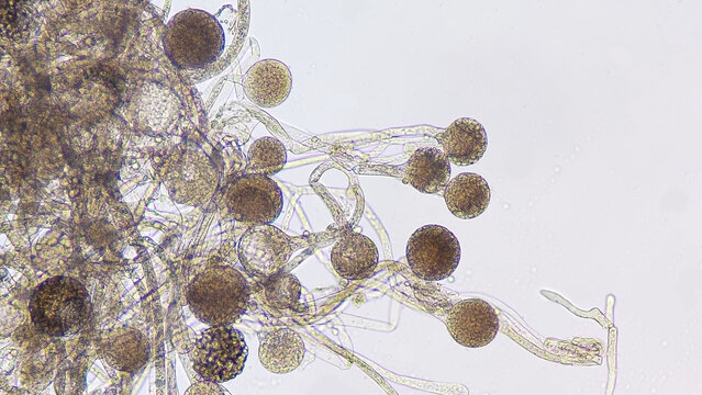 Rhizopus oryzae, a filamentous heterothallic microfungus. Fresh sample. 100x magnification