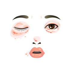 woman has allergic face