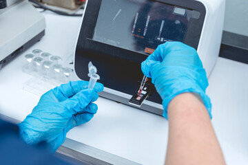 Conducting a HbA1c blood test at the laboratory. Checking for blood sugar levels of a patient on a...