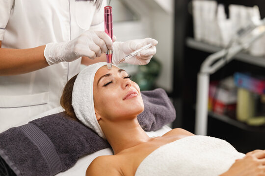 Dermapen Micro-needling Treatment In A Beauty Salon