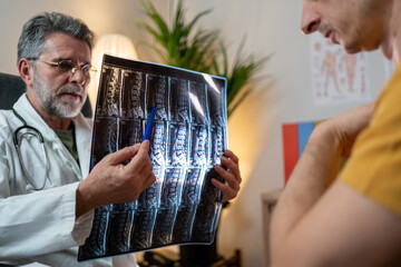 Radiologist doctor examining spinal column by radiography, x-ray and magnetic resonance in...