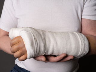 Hand in plaster, big bruise on hand. Cropped photo of a man. After surgery. Joint replacement. Prerel.