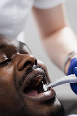 Dental drill close-up. Dentist drilling teeth of african man in dentistry clinic. Teeth treatment. Dental filling for african american man patient.