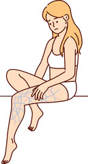 Upset woman in lingerie looks in bewilderment at leg with swollen veins after unsuccessful walk