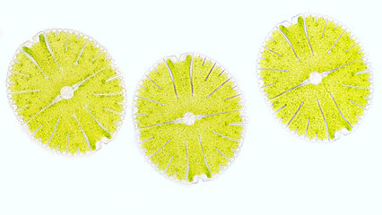 Beautiful microscopic green algae from genus Micrasterias. The species probably Micrasterias...