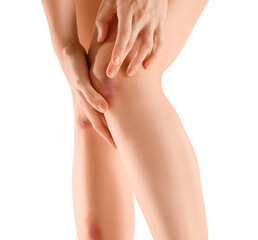 Young woman with bruised legs on white background, closeup