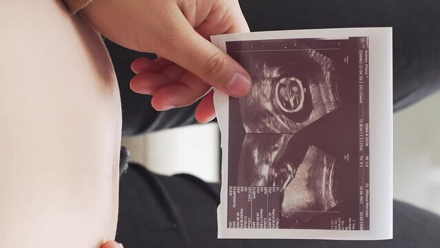 Female holding ultrasound picture and rubbing her belly, close up view vertical