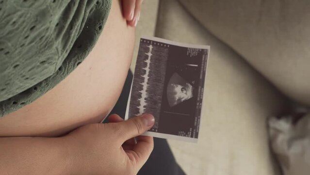 Pregnant woman rubs her belly while holding ultrasound picture, view from above
