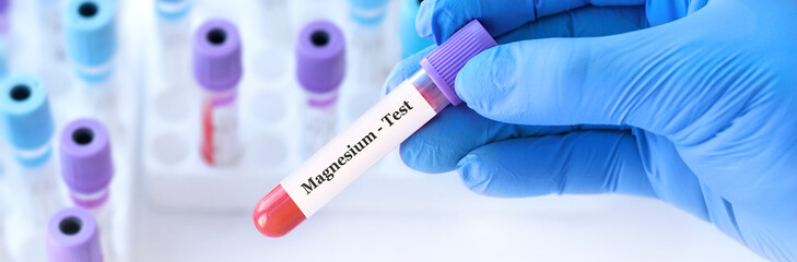 Doctor holding a test blood sample tube with Magnesium test on the background of medical test tubes with analyzes