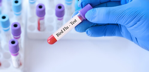 Doctor holding a test blood sample tube with Bird Flu test on the background of medical test tubes...