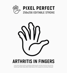 Arthritis in fingers thin line icon. Inflammation in joints. Osteoarthritis. Pixel perfect, editable stroke. Vector illustration.