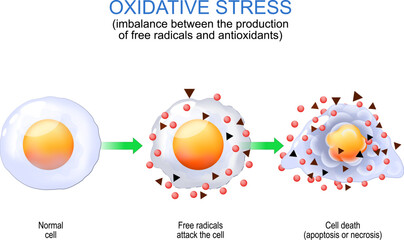 Oxidative stress. free radicals and antioxidants.