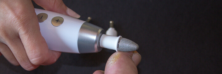 Image of a mini drill used by a beautician as she removes dead skin from a big toe. Calluses...