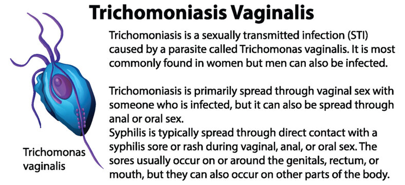 Trichomoniasis Vaginalis with explanation