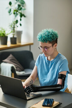 Young woman with disability sitting at table and working online on laptop in the room