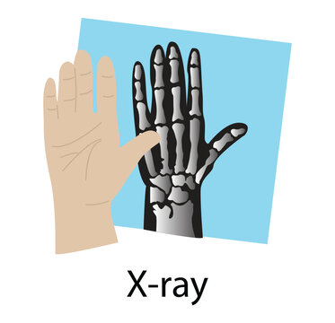 illustration of biology and physics, X ray image of human wrist and hand, X radiation is a penetrating form of high energy electromagnetic radiation