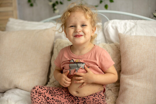 Little toddler girl with chicken pox in bed, playing at home, quarantine isolation
