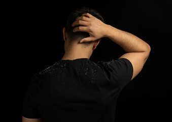 Close up low key portrait of man with dandruff or itchy hair problem. Concept of hair care, ...