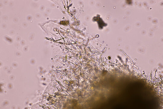 Microplastics inside the soil observed under a 40x microscope macro lens in an environmental health laboratory. This image represents non-recyclable plastic particles contaminating agricultural soil. 