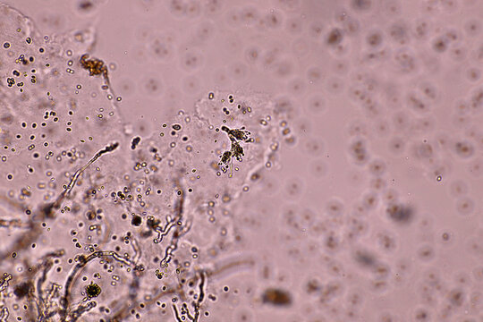 Microplastics inside the soil observed under a 40x microscope macro lens in an environmental health laboratory. This image represents non-recyclable plastic particles contaminating agricultural soil. 