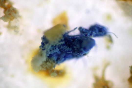 Microplastics inside the soil observed under a 40x microscope macro lens in an environmental health laboratory. This image represents non-recyclable plastic particles contaminating agricultural soil. 