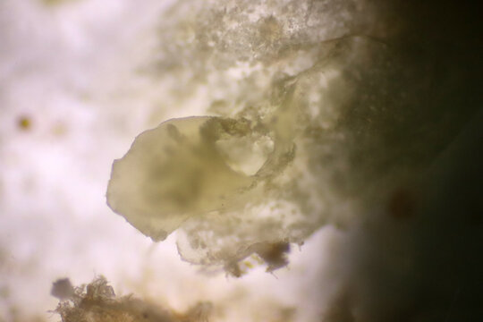 Microplastics inside the soil observed under a 40x microscope macro lens in an environmental health laboratory. This image represents non-recyclable plastic particles contaminating agricultural soil. 