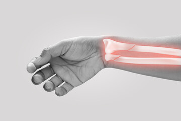 Men at higher risk of ulna fracture. Pain concept