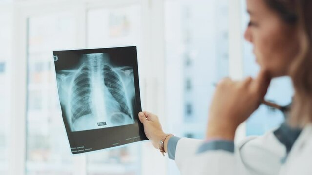 X ray, analysis and woman doctor thinking of healthcare research, solution and review of skeleton, spine problem. Radiology professional, medical worker or female in xray anatomy career contemplating