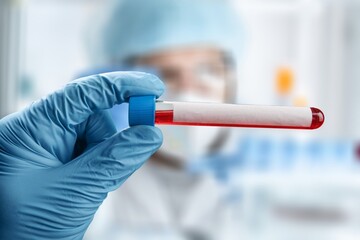 Doctor holding test tube with blood