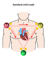 Standard Limb Leads ECG - Einthoven Triangle - Electrocardiogram - Medical Vector Illustration