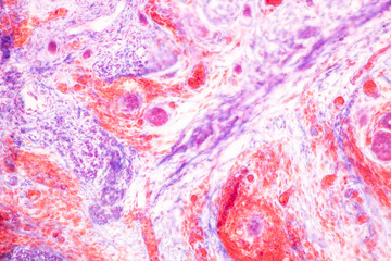 Characteristics Tissue of Skin from finger Human and Nail development finger of Human under the microscope in Lab.