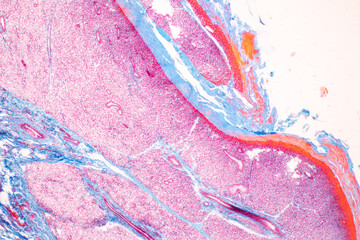 Anatomy and Histological Tonsil and Parotid Human cells under microscope.