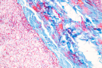 Anatomy and Histological Tonsil and Parotid Human cells under microscope.