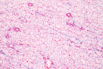 Anatomy and Histological Tonsil and Parotid Human cells under microscope.