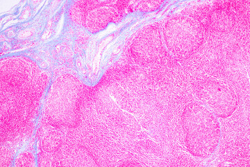 Anatomy and Histological Tonsil and Parotid Human cells under microscope.