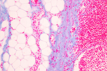 Anatomy and Histological Tonsil and Parotid Human cells under microscope.