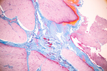 Anatomy and Histological Tonsil and Parotid Human cells under microscope.