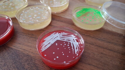 Petri dish with colonies of microbes, fluorescent microbes; blood agar with bacterial colonies