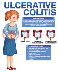 Ulcerative Colitis Symptoms Infographic