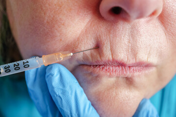 senior woman gets injection in her lips. Woman in beauty salon. plastic surgery clinic. - obrazy, fototapety, plakaty