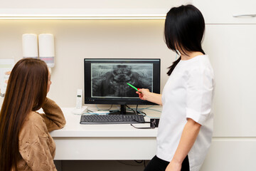 Fototapeta na wymiar Attractive female dentist talks with the patient, shows a photo of her teeth on the monitor, the problem that needs to be solved and the tooth cured. Modern technologies in dental treatment.