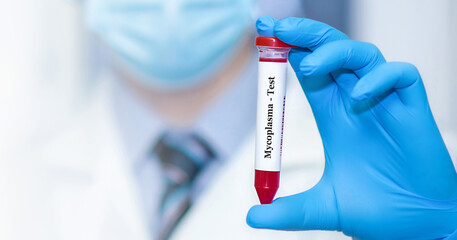 Doctor holding a test blood sample tube with Mycoplasma test