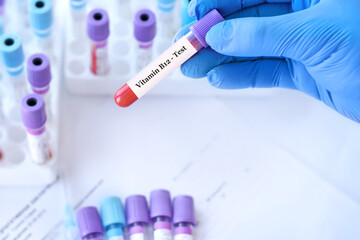 Doctor holding a test blood sample tube with Vitamin B12 test on the background of medical test...